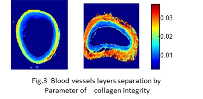 Image - Blood vessels layers separation