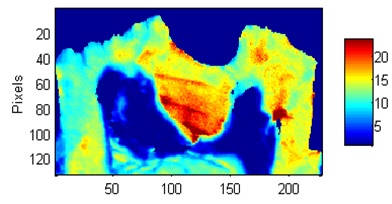 Image - mineral/matrix spatial distribution - mouse tooth