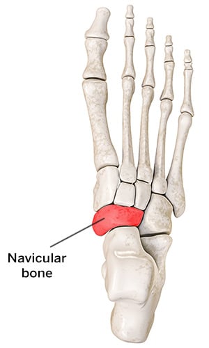 Bones of the foot with navicular highlighted.