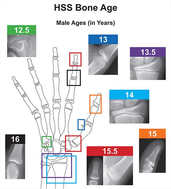 Bone age hand diagram