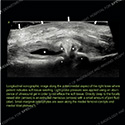 Ultrasound case 163 thumbnail