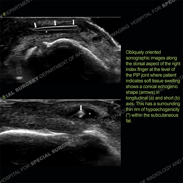 Ultrasound Case 164