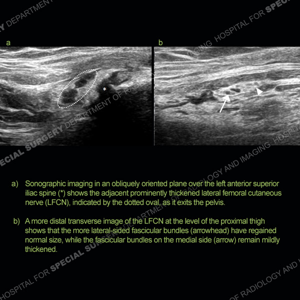 Ultrasound Case 167