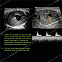 Ultrasound case 168 thumbnail