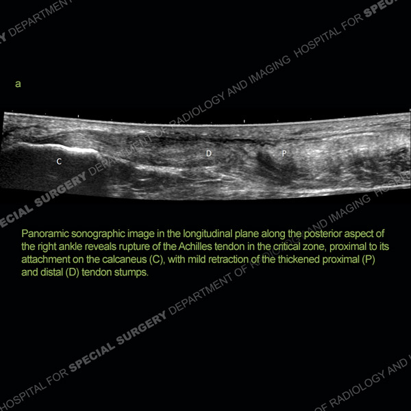 Ultrasound Case 169