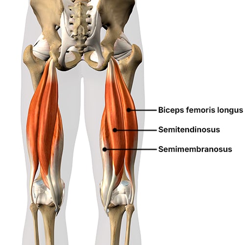 Illustration of the three hamstring muscles in which the biceps femoris longus is on the lateral (outter) side of the thigh, the semimembranosus on the medial (inner) side of the thigh and the semitendinosus muscle is sandwiched between them.
