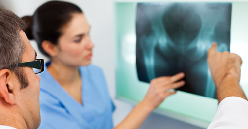 Clinicians examing a hip X-ray.