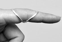 Silver ring splint.