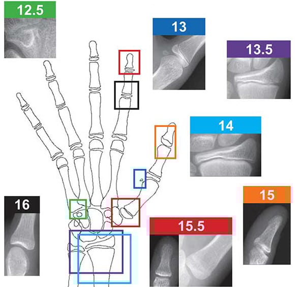 bone age hand diagram