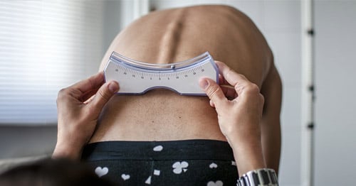 An examination for scoliosis.