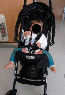 A child wearing a spica cast sitting in a stroller.
