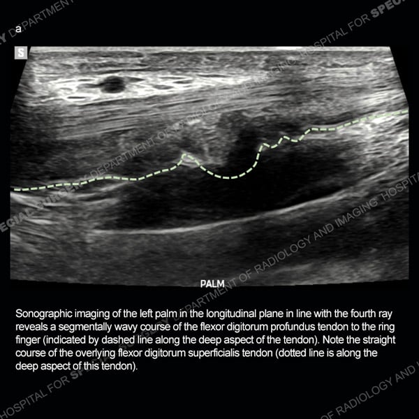 Ultrasound Case 182