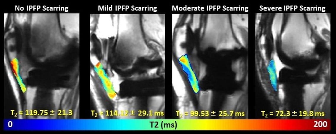 Orthopedic Hardware Image