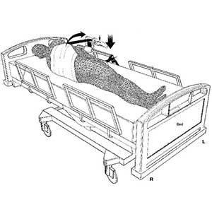 Patient Turning Assist