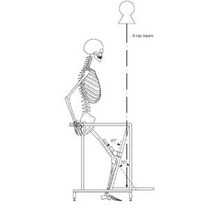 Positioning Device for Weight-Bearing Merchant Views