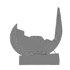 Revision Knee System