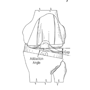 System and Method for Quantifying Gap Assessment