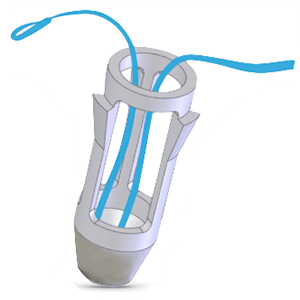 Tenodock - Docking Anchor for Tenodesis