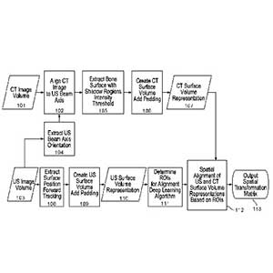 Ultrasound Navigated Spinal Guidance System