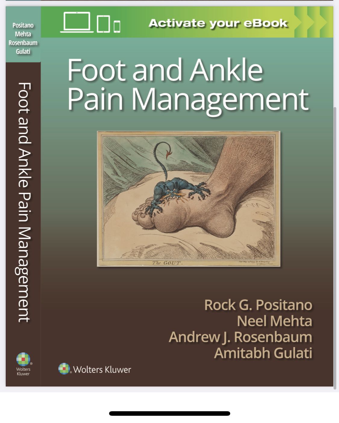 Ankle Fractures - Footcare Friday: Alpine Orthopedics and Sports Medicine:  Orthopedic Surgery