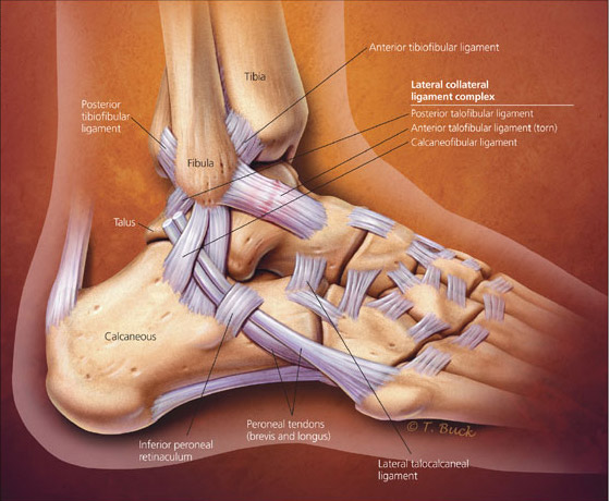 Illustration of the anatomy of the ankle for an article about High Ankle Sprains.