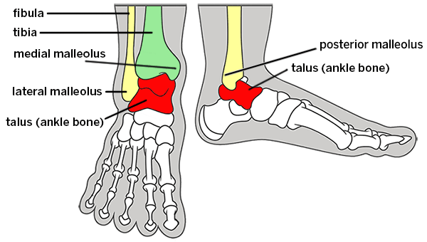 Broken Ankle: Types of Fractures, Diagnosis & Treatments