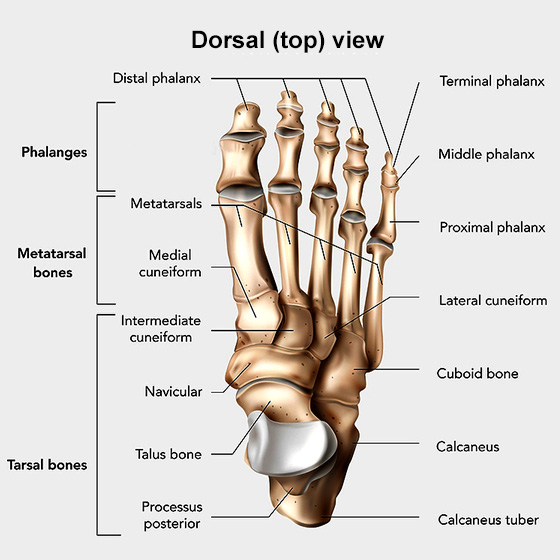 Midfoot Fusion: Orthopedic Surgery for Arthritis Pain