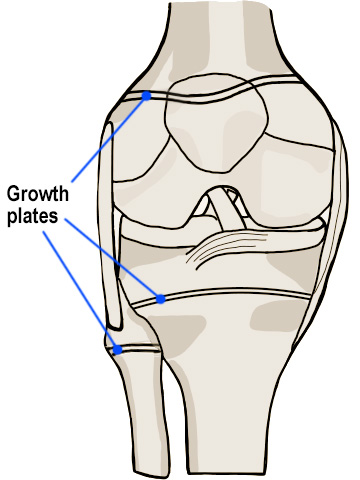 Growth plates in the bones of a child's knee.