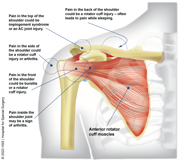 Rotator Cuff Muscles And Shoulder Pain – Why Does It Happen?