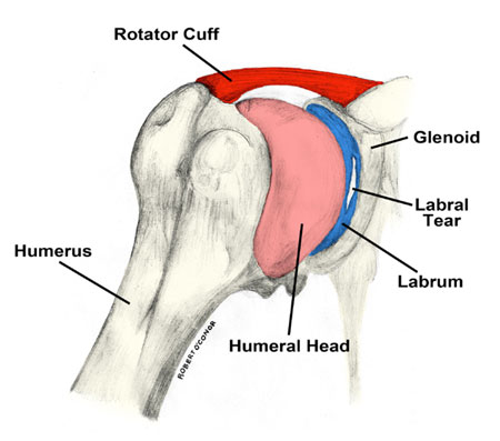 Torn Shoulder Labrum: Causes, Symptoms, Treatment, Recovery