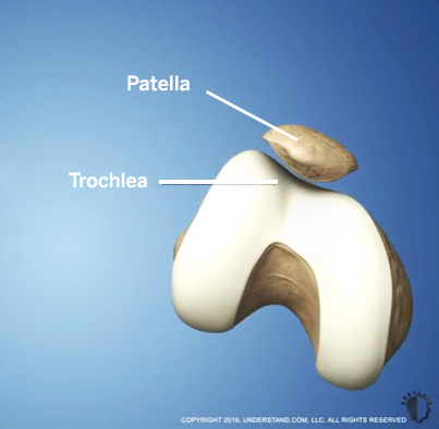 Patellofemoral Joint Replacement