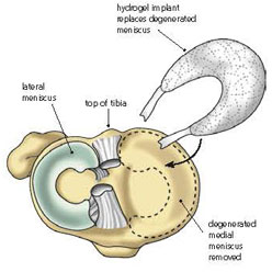 Orthopedic Inventions Expand the Possibilities of Movement