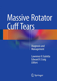 rotator cuff doctor