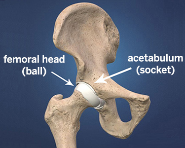 Dislocated Hip Symptoms, Diagnosis and 