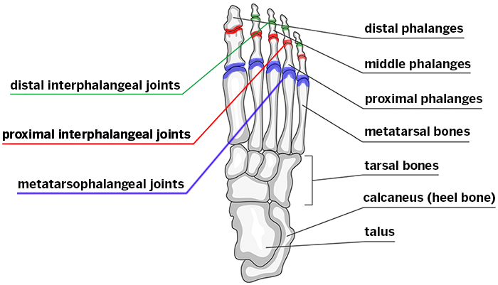 Hammertoe Information Patients: Foot & Ankle