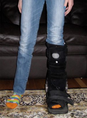 Photo of a child wearing a walking boot