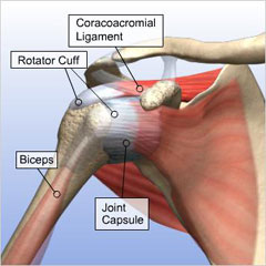 rotary cup shoulder