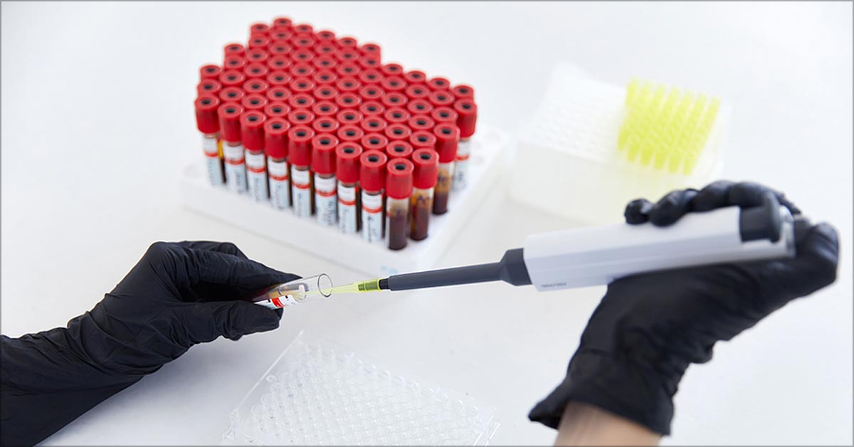 What Is the Anti-Cyclic Citrullinated Peptides (Anti-CCP) Blood Test?