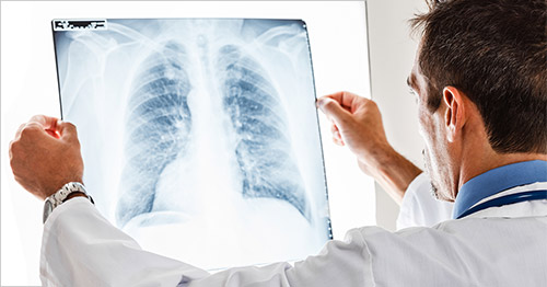 A doctor looking at a chest X-ray.