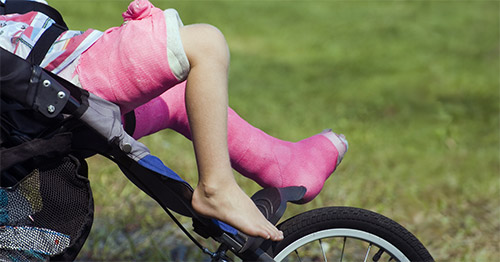 A child with broken legs in a stroller.