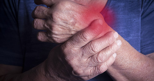 lupus and rheumatoid arthritis symptoms