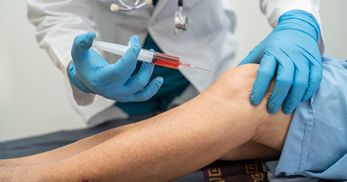 A doctor giving a therapeutic injection in the knee.