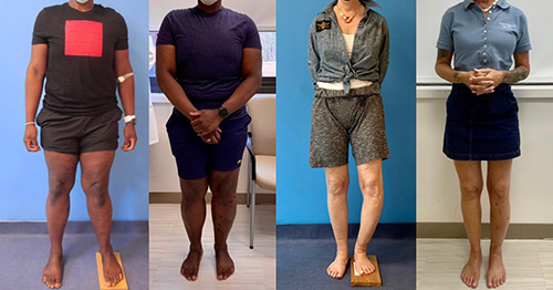 Person with corrected leg length differences before and after the operation.