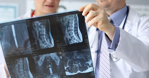 Doctors holding imaging of a patient's spine.